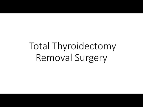 Thyroid Cancer Surgery | Total Thyroidectomy Removal by Dr. Majid Ahmed Talikoti - Onco Surgery