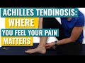 Achilles Tendonitis - Where you Feel your Pain Matters