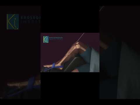 How to Repair a Shin Bone - Surgery Animation