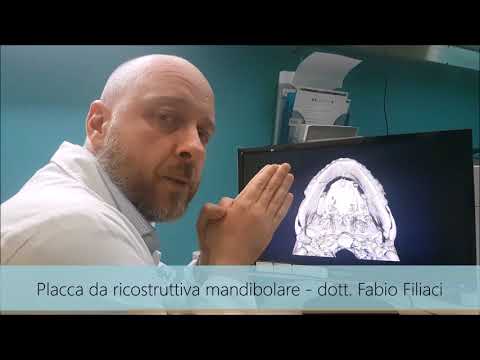 Dolore nella zona della schiena sotto la scapola sinistra Riabilitazione dellarticolazione del dito