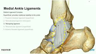 Using Ultrasound to Evaluate the Medial Ankle