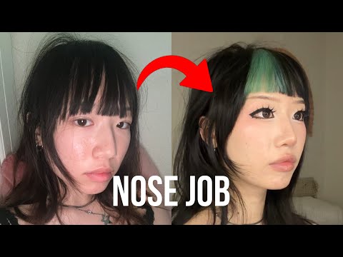 i got a nose job in korea