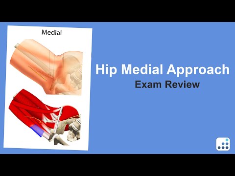 Hip Medial Approach Exam Review - Doug Padgett, MD