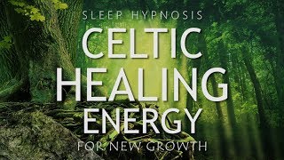 Sleep Hypnosis for Celtic Healing Energy | Clearing Negativity for New Growth