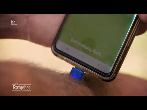 "Heat it" – Die Innovation des Stichheilers |ratgeber