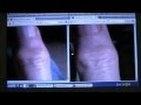 Vitamin B12 und Gelenke Aus denen die Ränder des hinteren rechten entsprechen