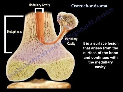 Osteoarthritis guidelines 2022