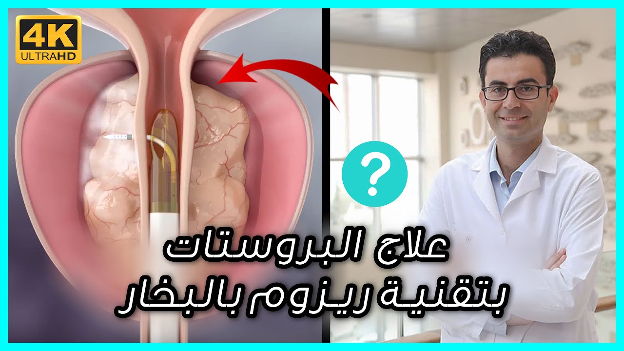 تقنية الريزوم لمعالجة تضخم البروستات الحميد بالبخار بدون جراحة - مع البروفيسور محسن بالابان