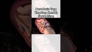 Download lagu Berat Janin Yang Tergolong Rendah Saat Lahiran mp3
