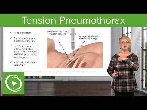 Tension Pneumothorax EMERGENCY! Don't Miss This Crucial Diagnosis