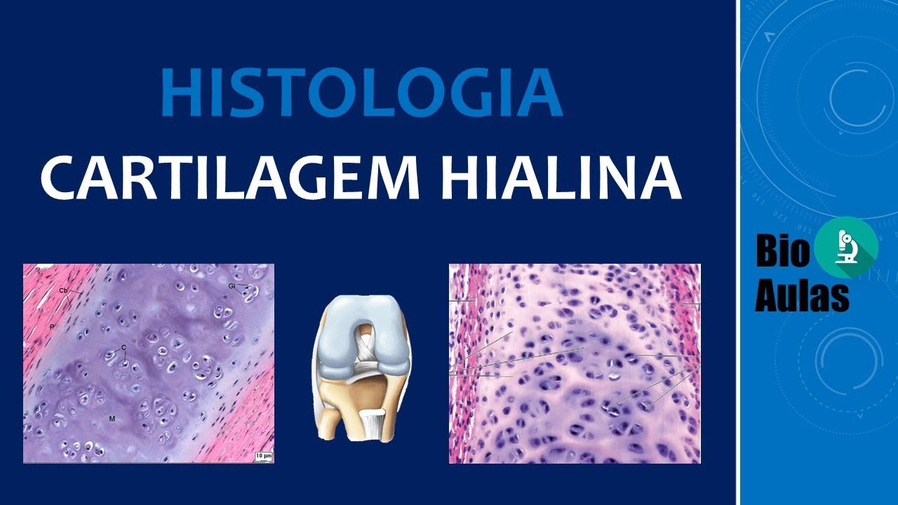 Cartilagem Hialina: Pericôndrio, Matriz Cartilaginosa (Tecido Cartilaginoso) - Histologia Humana