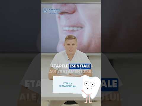 Dantură fixă pentru diaspora