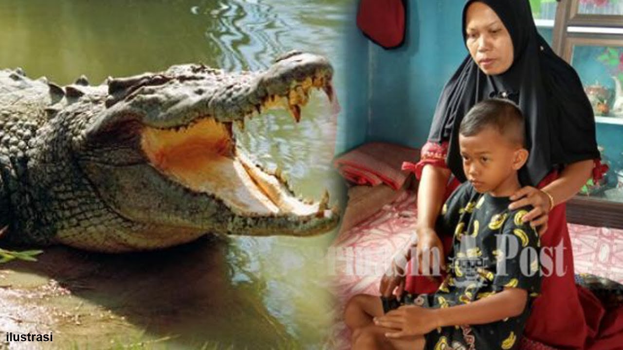 Perjuangan Ayah Di Kalsel Selamatkan Anaknya Yang Digigit Perjuangan Ayah Di Kalsel Selamatkan Anaknya Yang Digigit