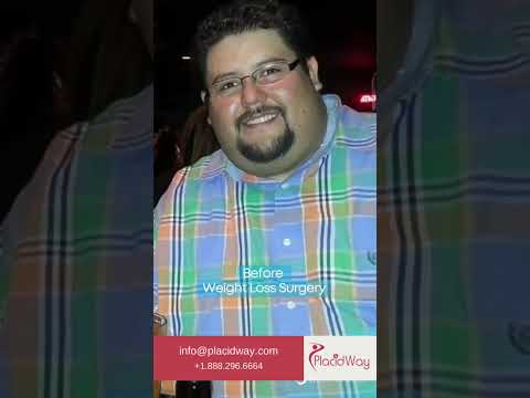 Weight Loss Surgery in Tijuana, Mexico by Dr. Jorge Maytorena – A Patient's Empowering Testimonial