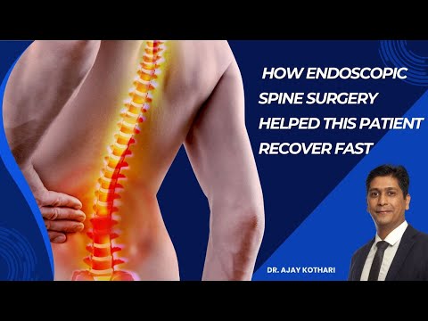 How Endoscopic Spine Surgery Helped This Patient Recover Fast | Dr. Ajay Kothari 