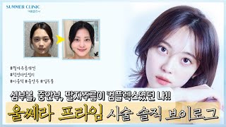심부볼, 중안부, 팔자주름이 컴플렉스였던 사람들 주목!! | 울쎄라프라임 시술 브이로그