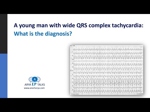A young man with wide QRS complex tachycardia