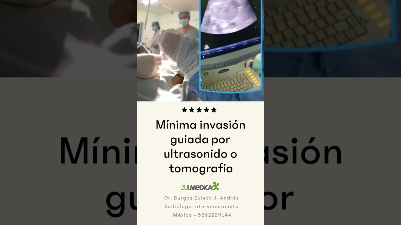 Jose Andres Burgos Zuleta-8