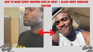 How to make every Ingrown hair go away | Black Men’s Skincare Routine | 2021