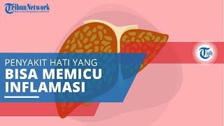 Hepatitis C, Disebabkan oleh Virus dan Dapat Memicu Infeksi dan Inflamasi pada Hati