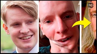 Download lagu ATHLETE who lost 'HALF HIS JAW' due to an UNTHINKABLE SITUATION underwent a PROCEDURE and STARTED... mp3