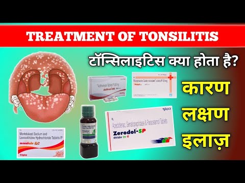 Tonsilitis in Hindi || Tonsillitis Causes, Symptoms & Treatment In Hindi || @PHARMACYTREEsangam