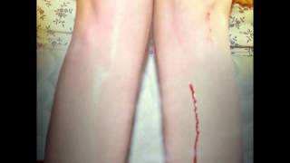 Los Campesinos! - A Heat Rash In The Shape Of The Show Me State Or, Letters From Me To Charlotte