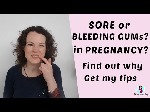 Sore, bleeding gums in pregnancy | Tips and Explanations