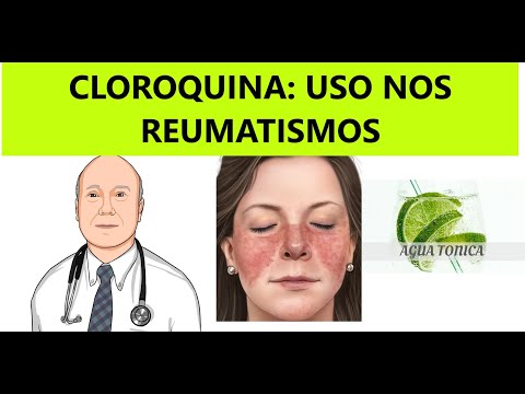 Chloroquine and hydroxychloroquine for rheumatism: what are the good uses and undesirable effects.