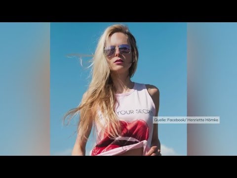 Gefährliche Essstörung: Das macht Magersucht mit dem Körper