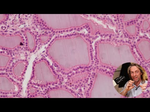 Histology of the thyroid and parathyroid glands