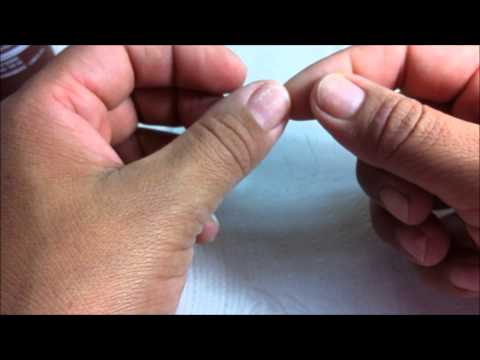 El hongo sobre las uñas en las manos a los niños de la foto el tratamiento El precio en mikozan del hongo de las uñas