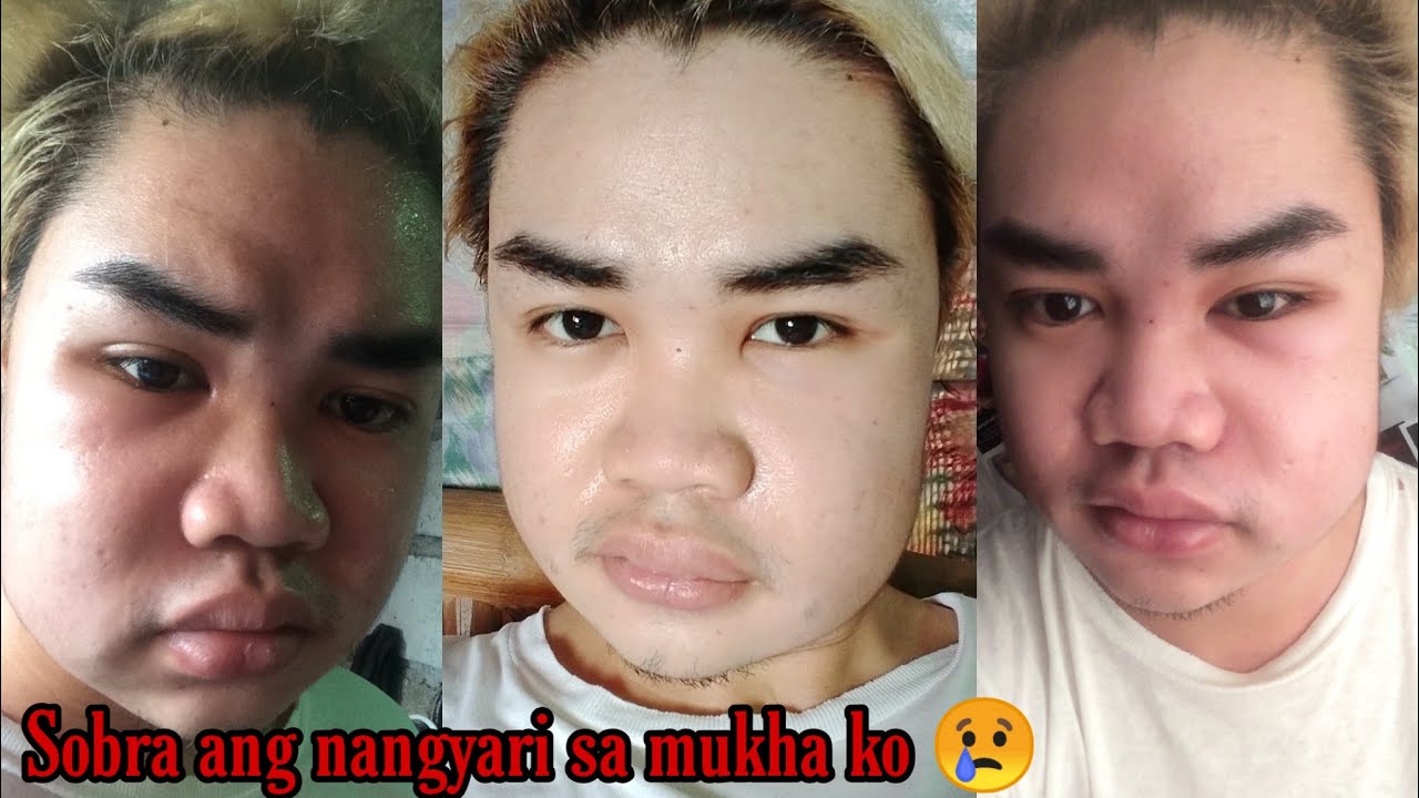 NA MAGA MUKHA KO DAHIL SA NGIPIN! |JonMagat