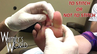 Gymnastics Injury | To Stitch or Not To Stitch | Whitney Bjerken