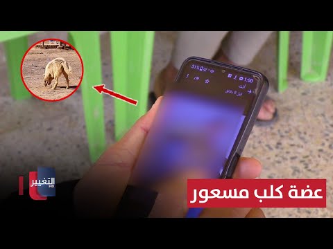 فيديو | السبب ذاته يتكرر.. عضة كلب مسعور أودت بحياة محمد في بابل | تقرير