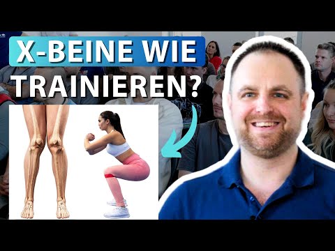 X-Beine wegtrainieren oder korrigieren? (Alles zu Ursachen, Symptomen & Training)