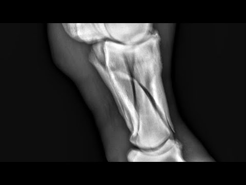 Horse Fractures - Leg Pain - Cast - Recovery