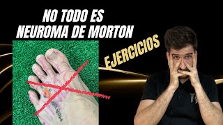 Ejercicios para el NEUROMA DE MORTON