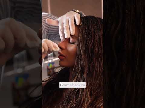 Ethnic Rhinoplasty in Turkey | Natural Results That Respect Your Features