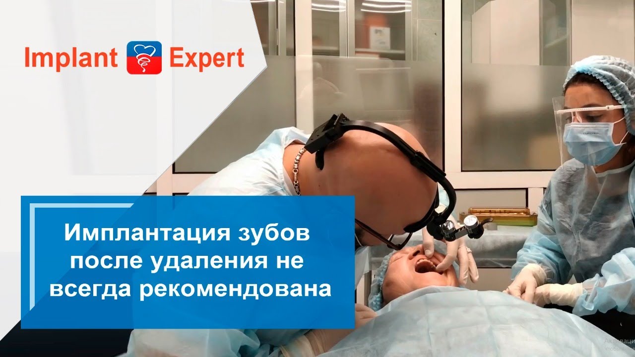 Имплантация зубов после удаления не всегда рекомендована