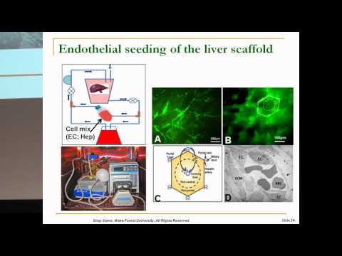 SENS5 - Tissue engineering of the liver using decellularised scaffolds