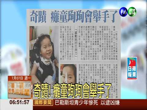 奇蹟! 癱童珣珣會舉手了