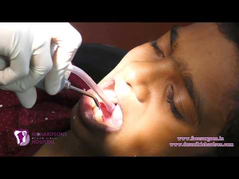 Video On Orthodontics