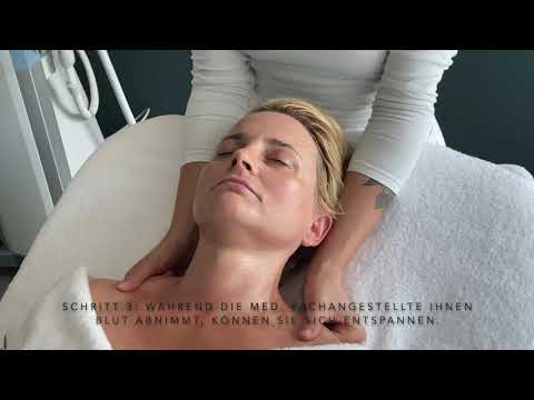 Microneedling mit PRP by Plastethics, Dracula Therapie mit Eigenblut