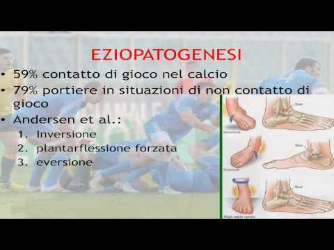 Quanto è un intervento chirurgico sul menisco del ginocchio a Mosca Articolazioni sanatorio della colonna vertebrale