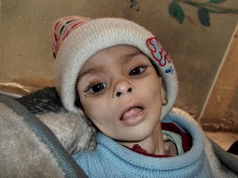 Click to Watch the 'God help us': Babies dying as humanitarian aid unable to reach starving populations (WARNING: GRAPHIC IMAGES) video