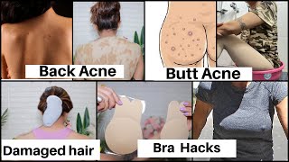 Life Hacks Every Girl should Know | Butt Acne, Back Acne, Breast, Hair | Rinkal Parekh