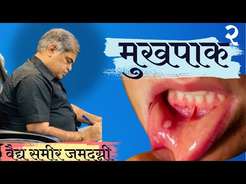 102 मुखपाक | STOMATITIS IN AYURVEDA | PART 2 | VD.SAMEER JAMADAGNI SIR