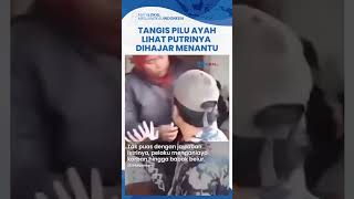 Tangis Pilu Ayah di Sulut Lihat Putrinya Babak Belur Dihajar Menantu, KDRT Diduga karena Cemburu