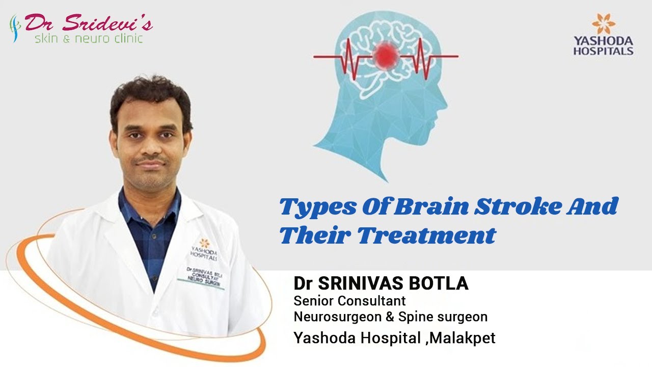 What is Brain Stroke?